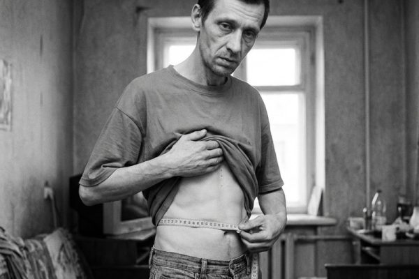 Suy Dinh Dưỡng: Nguyên Nhân, Dấu Hiệu Và Cách Khắc Phục