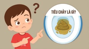 Tiêu Chảy – Nguyên Nhân, 4 Cách Xử Trí Nhanh Tại Nhà Hiệu Quả