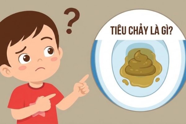 Tiêu Chảy – Nguyên Nhân, 4 Cách Xử Trí Nhanh Tại Nhà Hiệu Quả