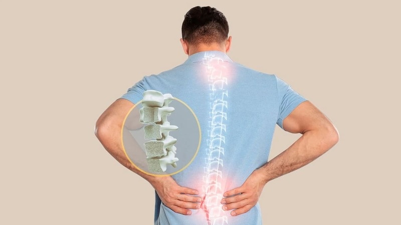 Thiếu hụt vitamin D và loãng xương ở người trưởng thành là một vấn đề sức khỏe phổ biến