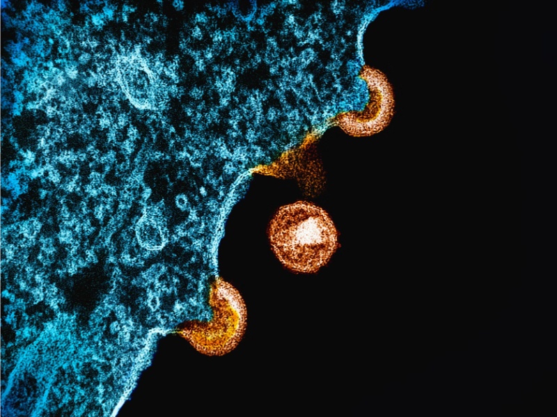 Tế bào miễn dịch hoạt động kém theo sự lão hoá tự nhiên của tuổi tác suy giảm miễn dịch tuổi trung niên